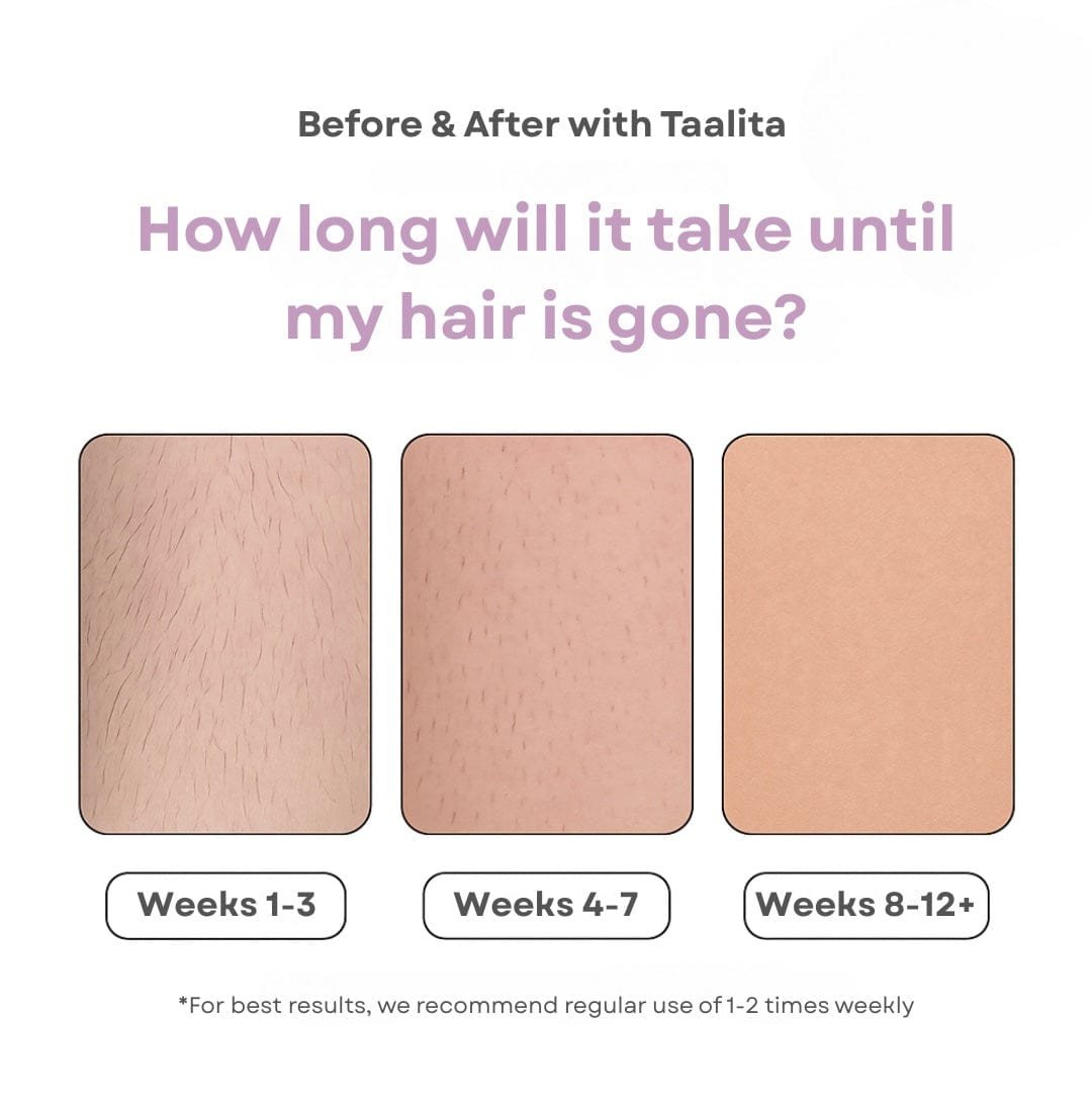 Mini Laser Hair Removal Device – Portable IPL Hair Remover 7 Mini Laser Hair Removal Device – Portable IPL Hair Remover - Image 7